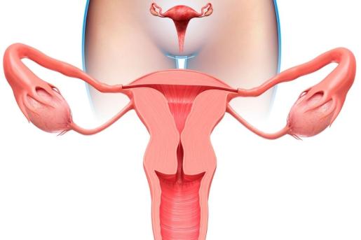 Uterin Miyom Embolizasyonu (UME) Nedir? Nasıl Yapılır?